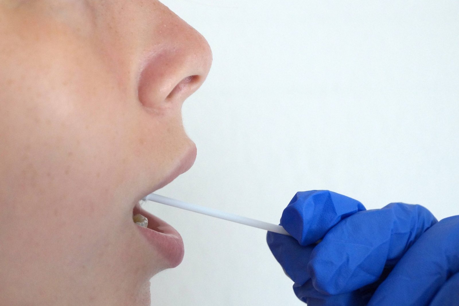 Urine Testing