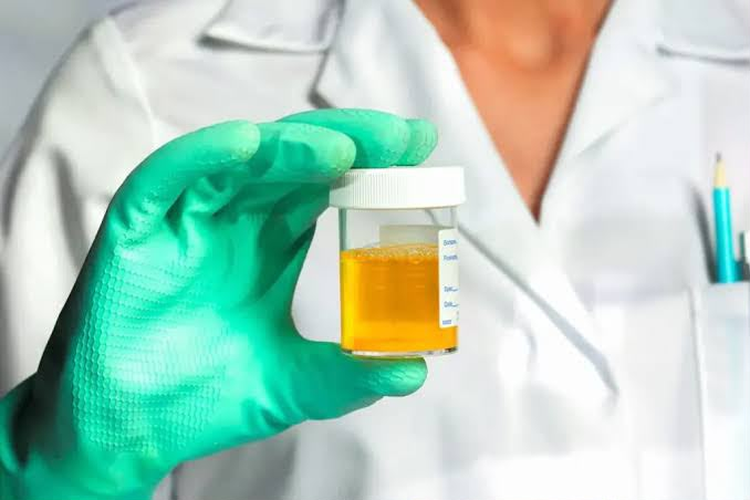 Urine Testing